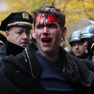 bloody protester