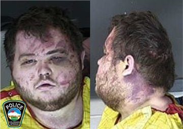 Mug Shot Released of Accused Colorado Gay Bar Mass Shooter