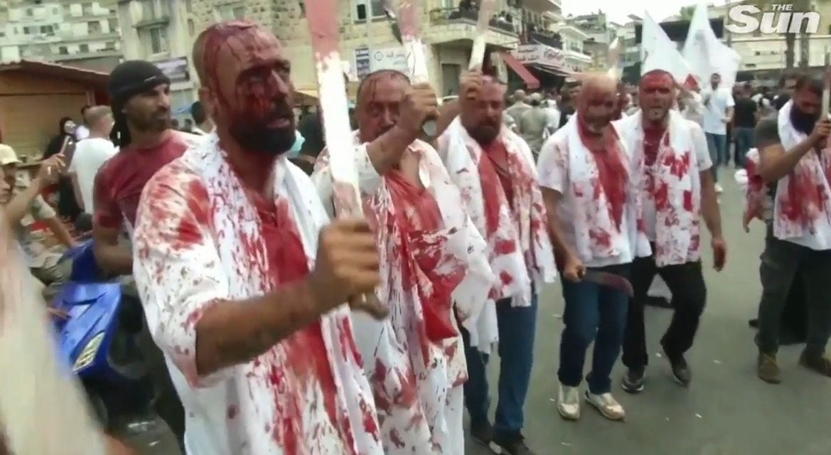 Muslims Use Knives to Slice Open Their Heads During Annual Ashura Festival (VIDEO)