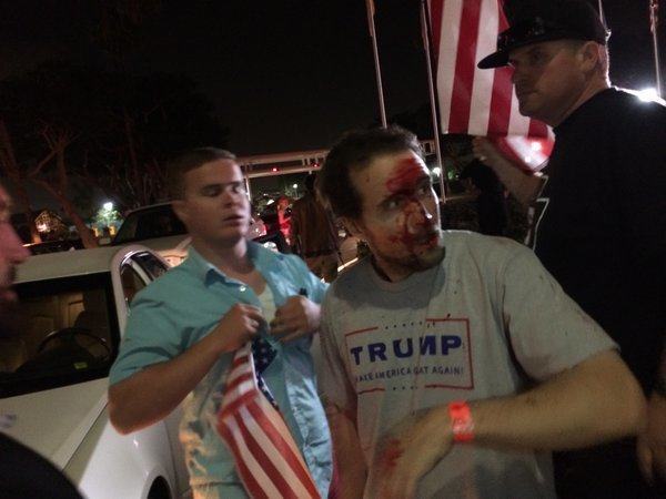 Trump Supporter Bloodied Pearce Twitter