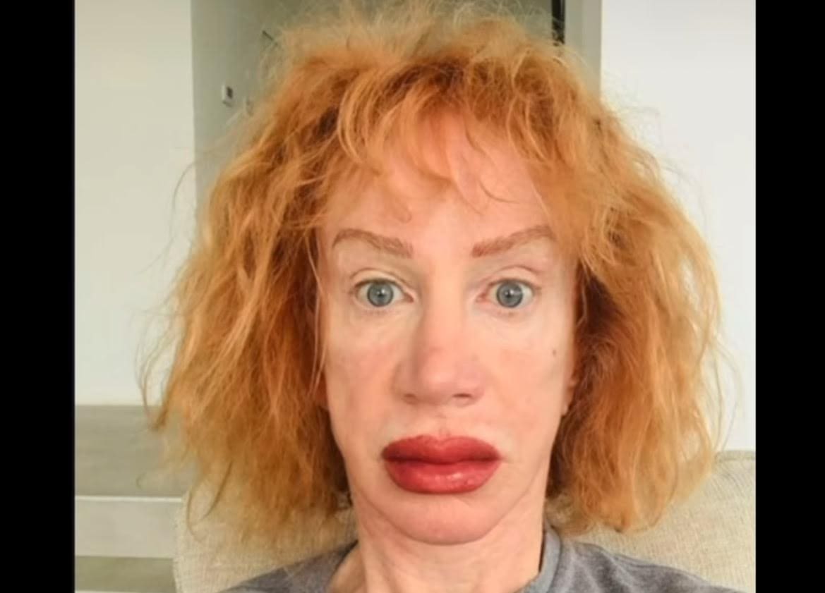 Kathy Griffin Brutalized After Posting Horrifying Photo of Her New Tattooed Lips
