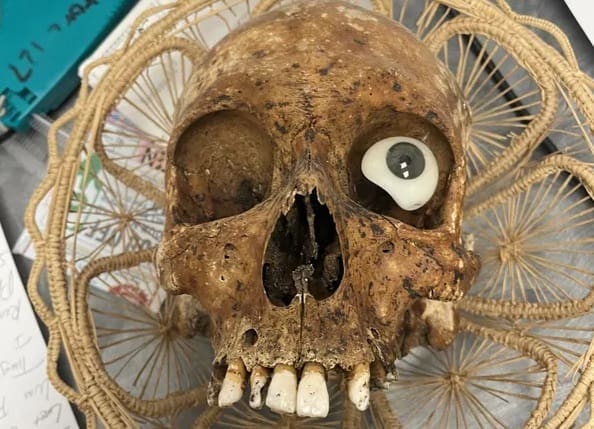 Human Skull Found in Arizona Goodwill Donation Box