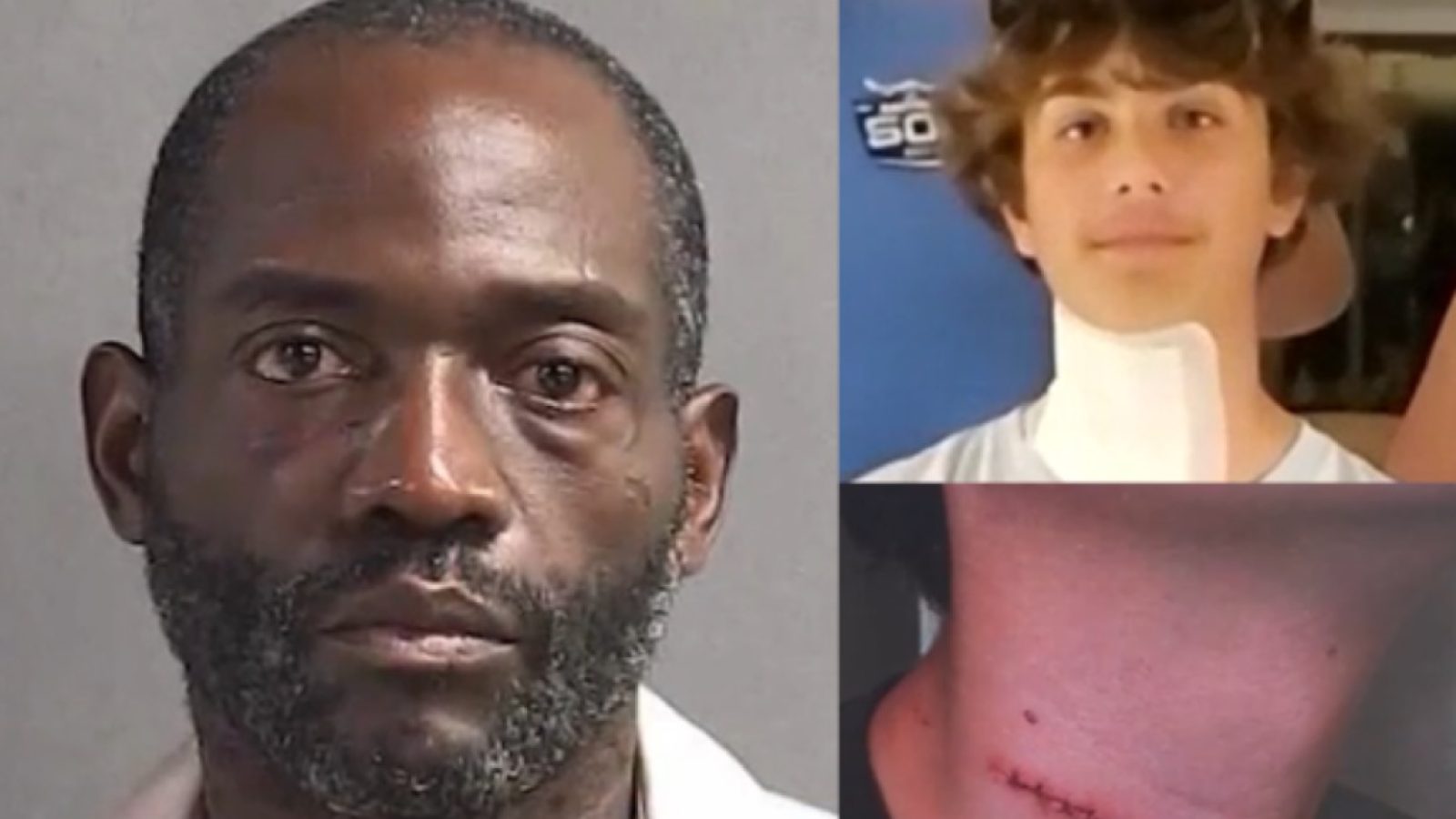Mugshot of a man alongside images of a young man with a neck injury and visible stitches, highlighting a serious incident or crime.