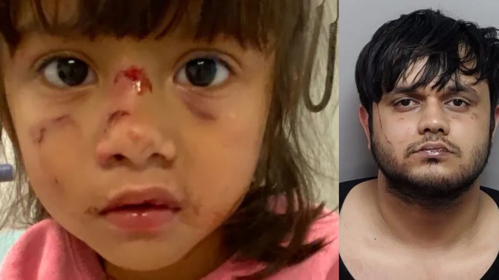 Image shows a young girl with facial injuries alongside a man in a police mugshot, highlighting a serious incident involving child safety and potential criminal activity.