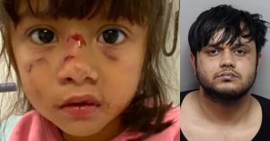 Image shows a young girl with facial injuries alongside a man in a police mugshot, highlighting a serious incident involving child safety and potential criminal activity.