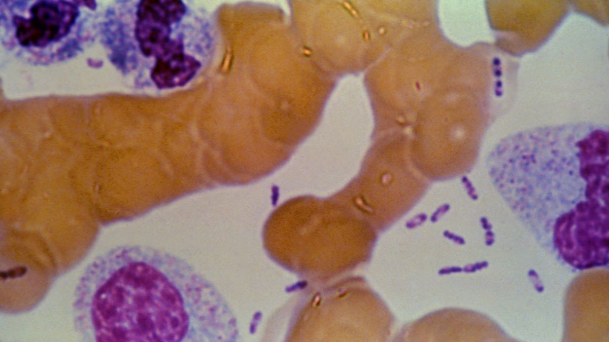 Possible Plague Crisis in Siberia: Five Hospitals Placed Under Quarantine After Lab Tech Dies Following Test Tube Accident Containing Plague Bacteria