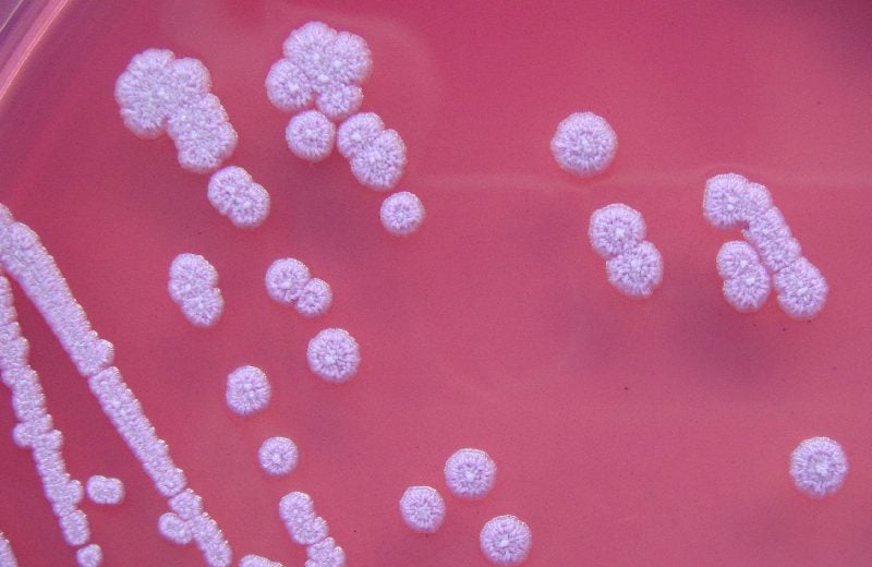 CDC Warns of a Bacteria that Causes Rare and Serious Disease Discovered in U.S. for 1st time in Environmental Samples