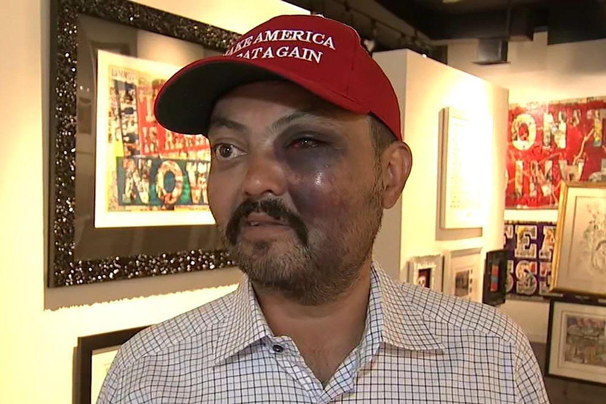 New York City Store Owner Beaten by ‘Pack of Teens’ For Wearing MAGA Hat