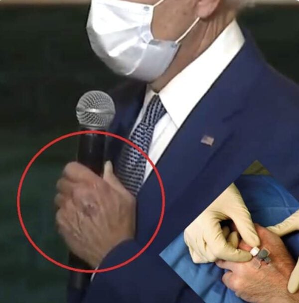 NEW PHOTOS Reveal Joe Biden Has IV Punctures On His Hand – And It’s Not the First Time