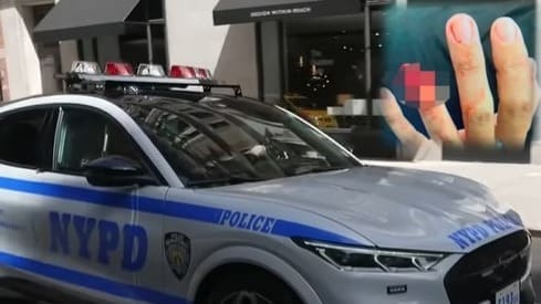 Illegal Alien Bites Off NYPD Sergeant’s Finger