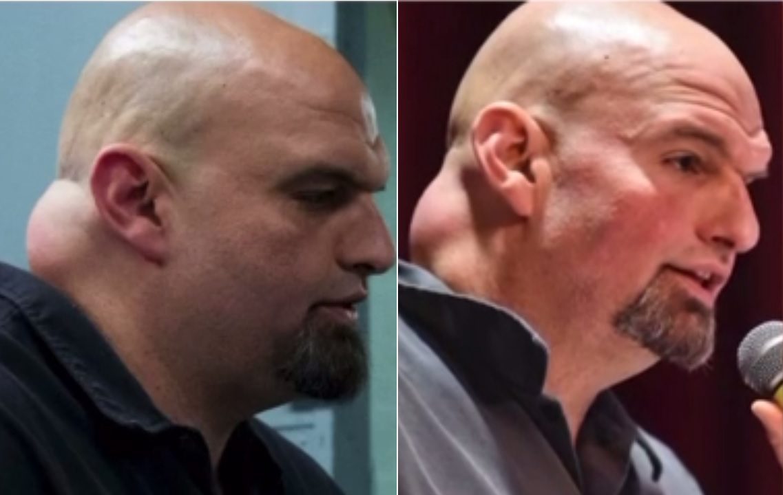 fetterman-neck-tucker-.jpg