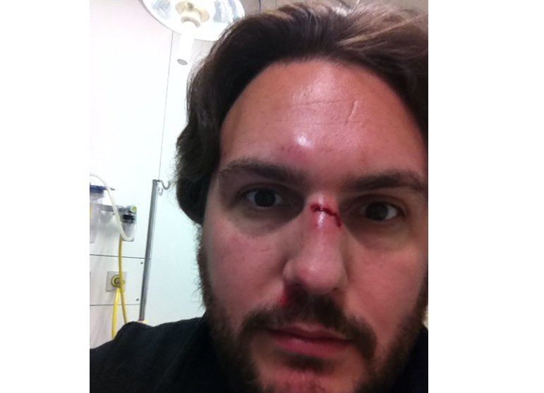 reporter stabbed calais