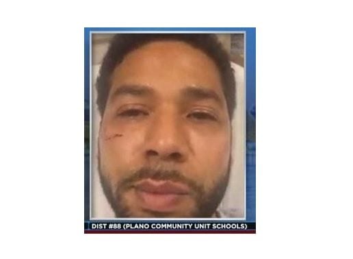 And There It Is–> Final Piece of Jussie Smollett MAGA Assault Illusion Turns Out to be Complete Crap